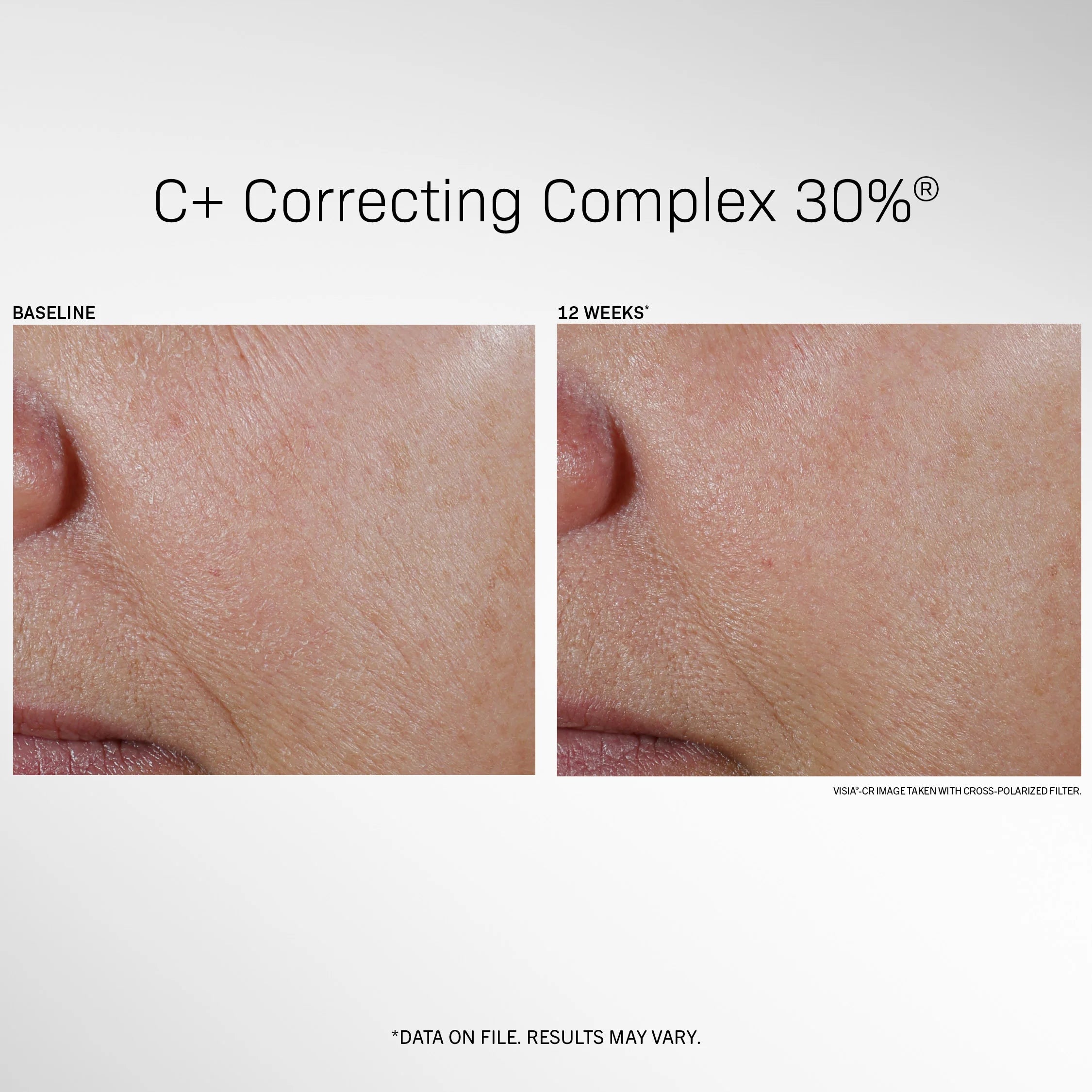 C+ Correcting Complex 30%