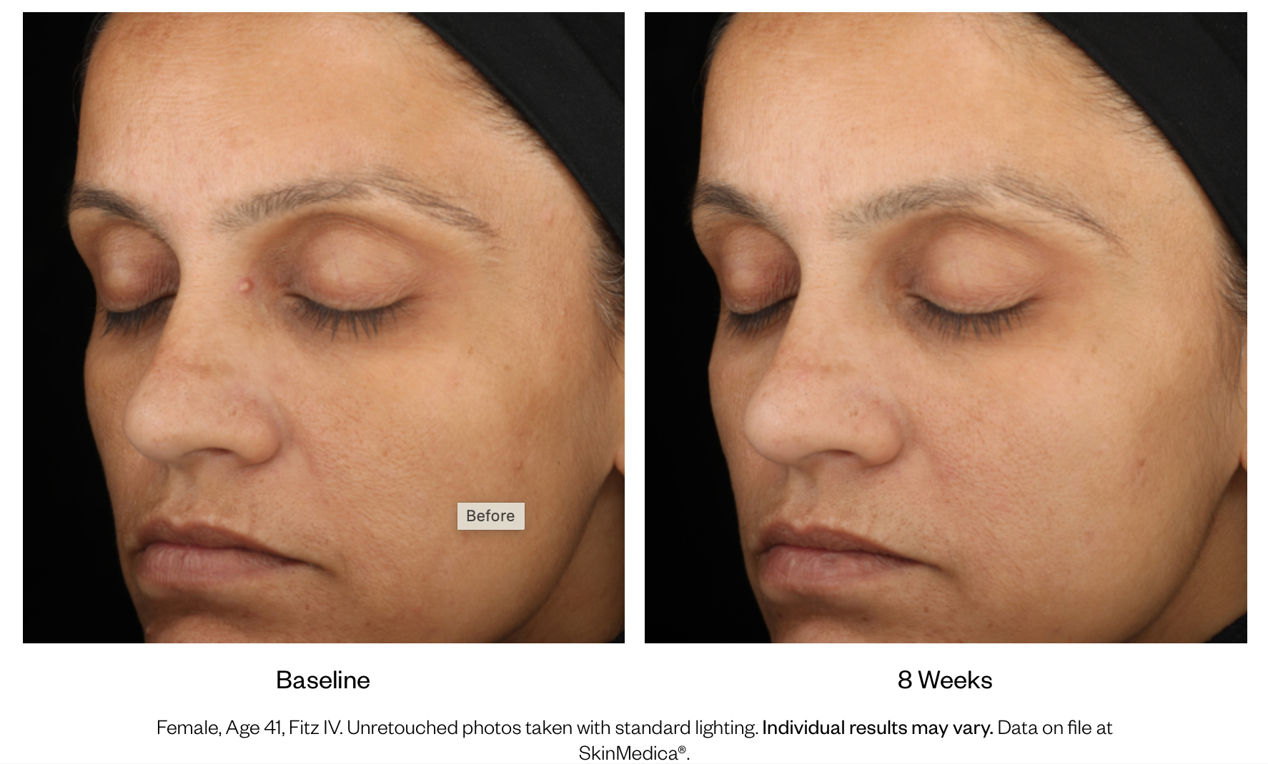 Lumivive System (Day and Night)