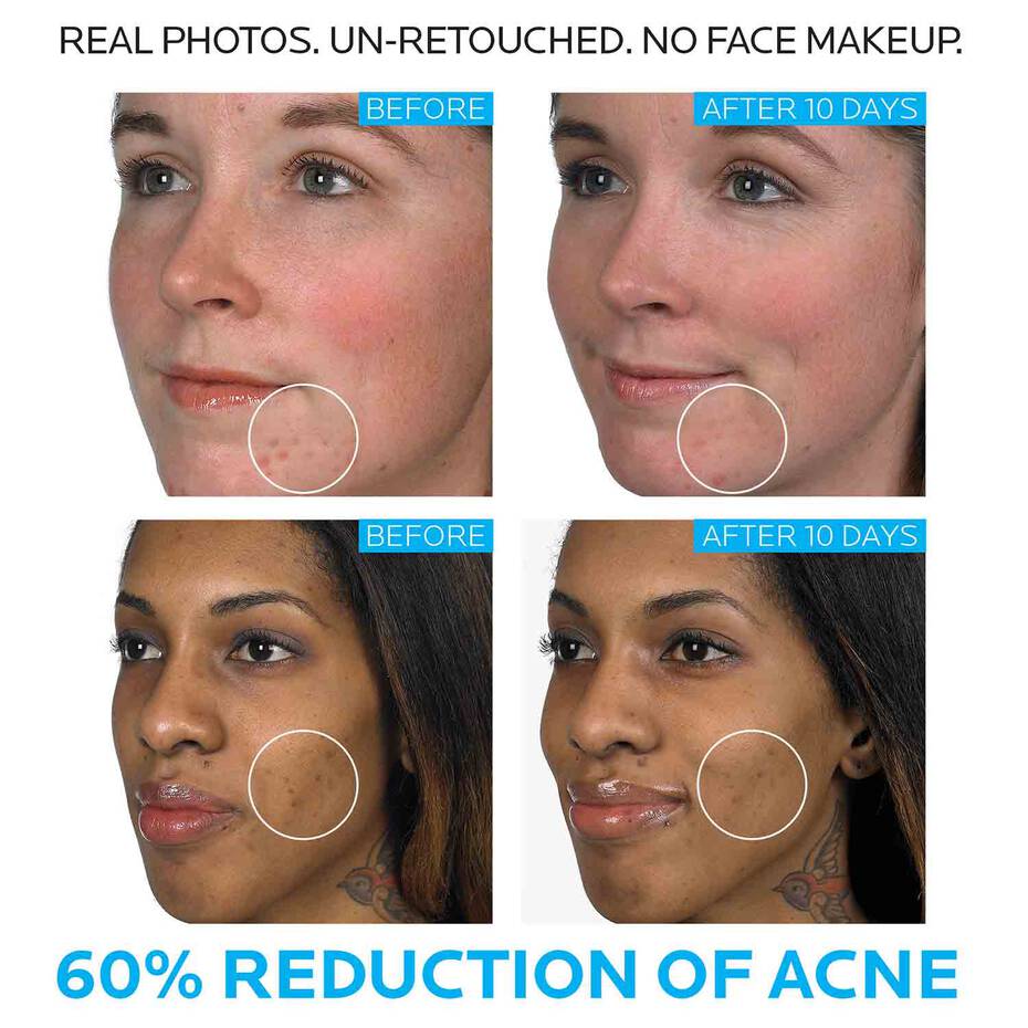 Effaclar Duo