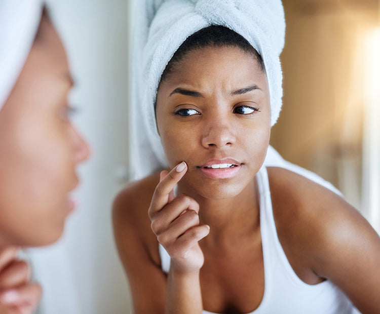 Your Ultimate Guide To Acne: Skincare, Triggers, And Solutions