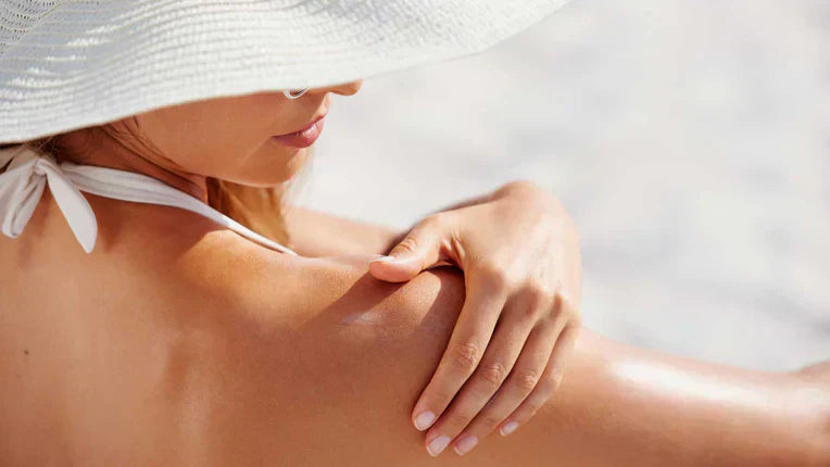 Soothing The Sting: Your Guide to Sunburn Relief and Recovery