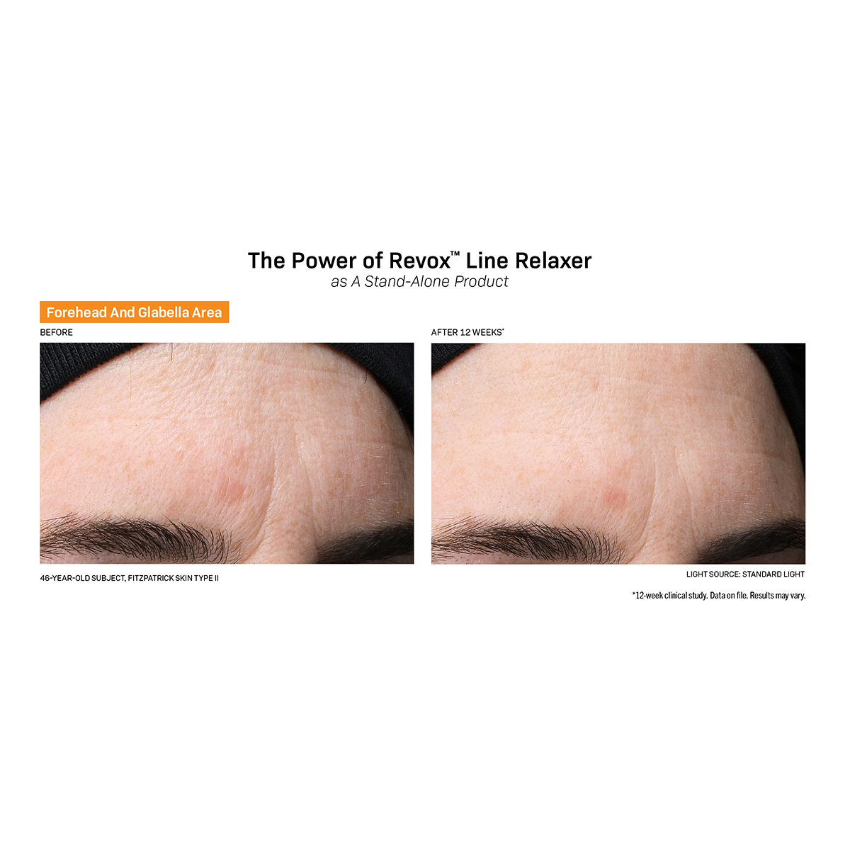 Revox Line Relaxer before and after